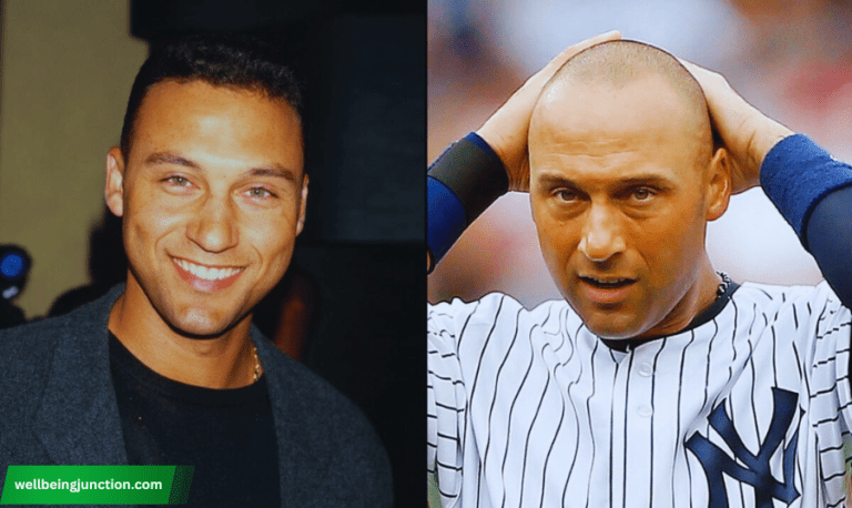 derek jeter hair loss