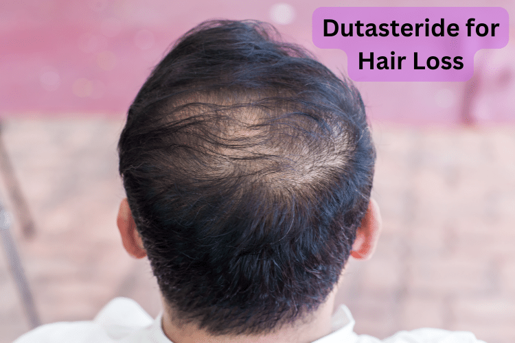 Dutasteride for Hair Loss