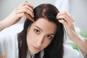 Can Dandruff Cause Hair Loss? Learn Prevention Tips! can dandruff cause hair loss?