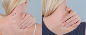 Tattoo Removal and Cosmetic Surgery: Combining Procedures for Optimal Results Tattoo Removal