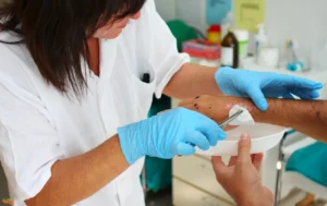 Mechanical Debridement: An Overview Mechanical Debridement