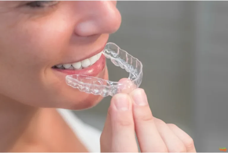 Orthodontic Treatment