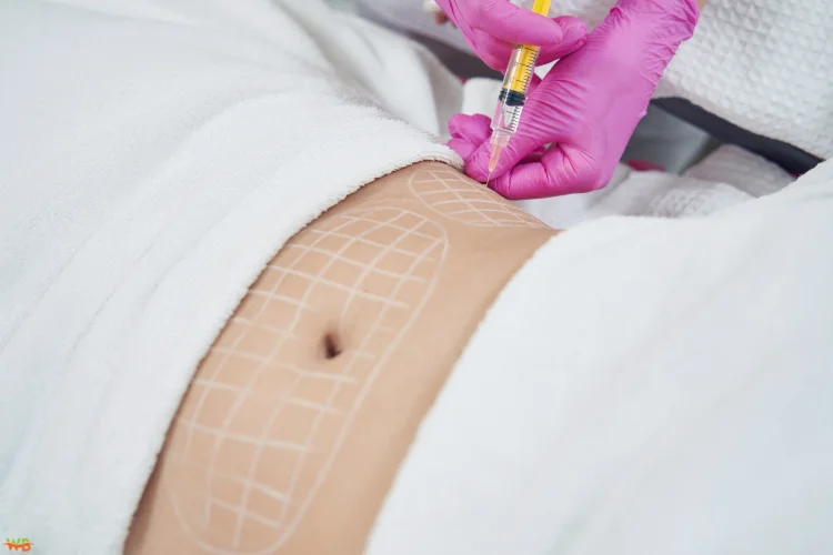 Understanding the Popular Body Contouring Procedures