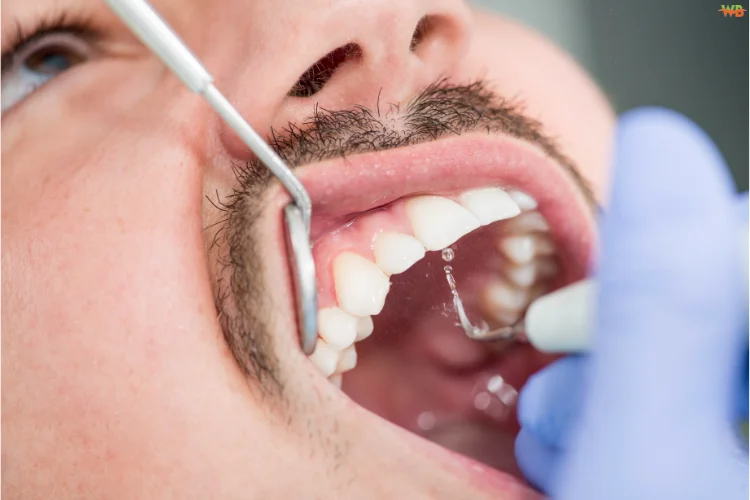 Why Oral Care Swabs Are Essential in Post-Surgery Recovery