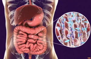 Do Probiotics Speed Up Metabolism? The Role of Intestinal Bacteria in Fat Burning Probiotics