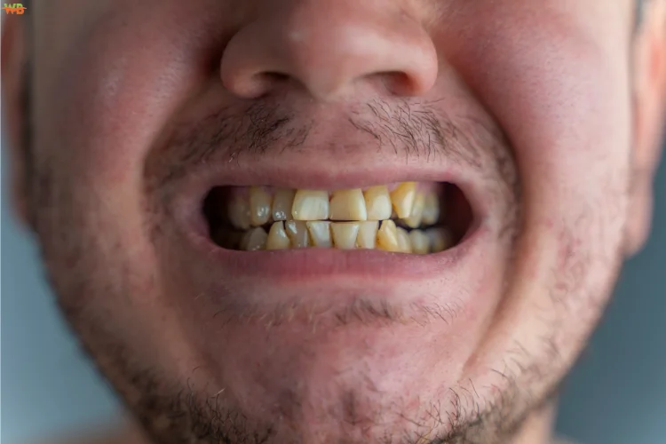 Avoid Harmful Oral Habits