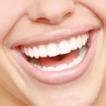 Teeth