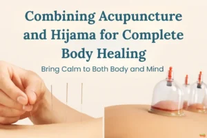 Acupuncture