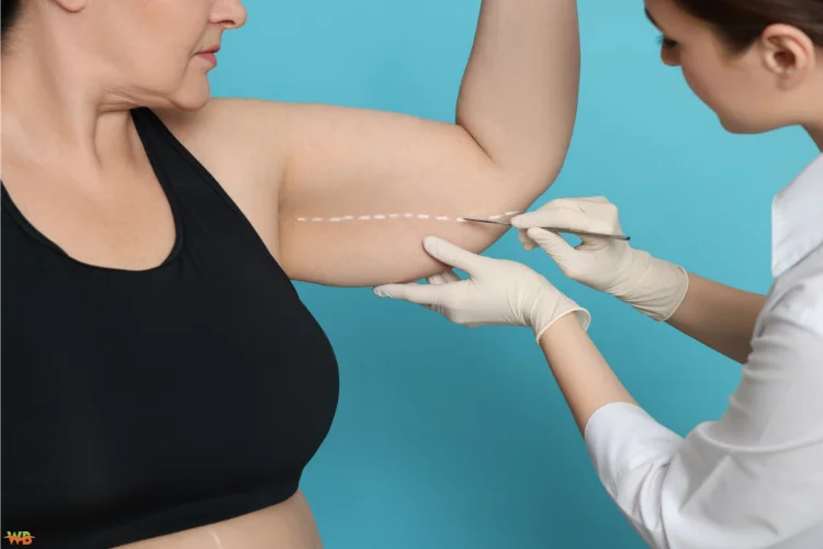 Liposuction: A Science-Driven Solution for Fat Removal