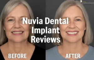 Nuvia Dental Implant Reviews