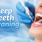 Deep Teeth Cleaning procedure showing dentist removing plaque below the gumline